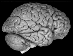 Normal Human Brain